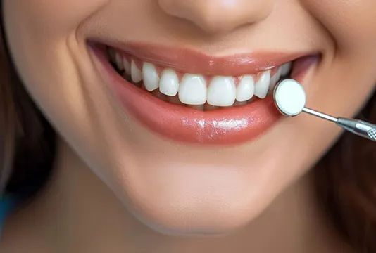 What Can Veneers Fix?