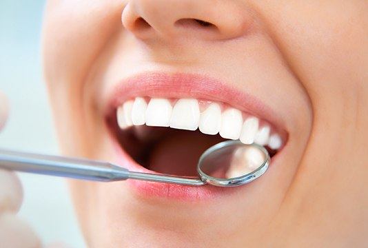 Closeup of patient receiving dental care