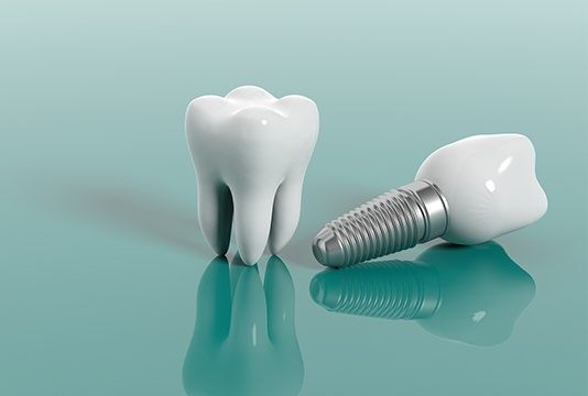 Model tooth and implant supported dental crown