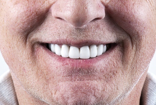 closeup of a person’s smile