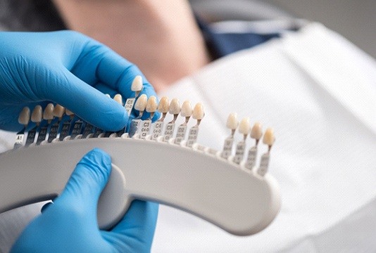 dentist matching the color of a patient’s teeth