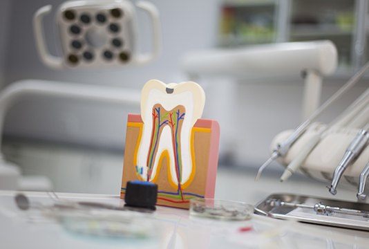 Model of the inside of the tooth