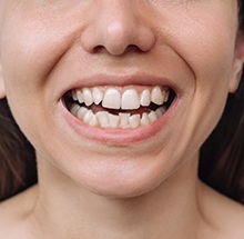Person with crooked teeth