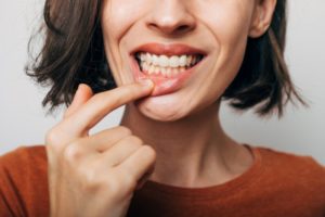 a woman showing her swollen gums