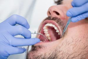 man at a dental cleaning