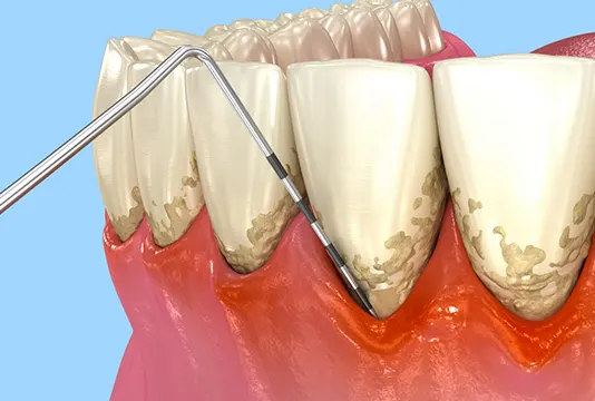 Patient receiving dental treatment
