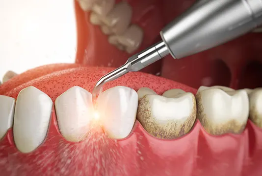 Patient receiving fluorid treatment
