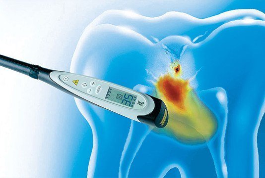 Cavity Detection System